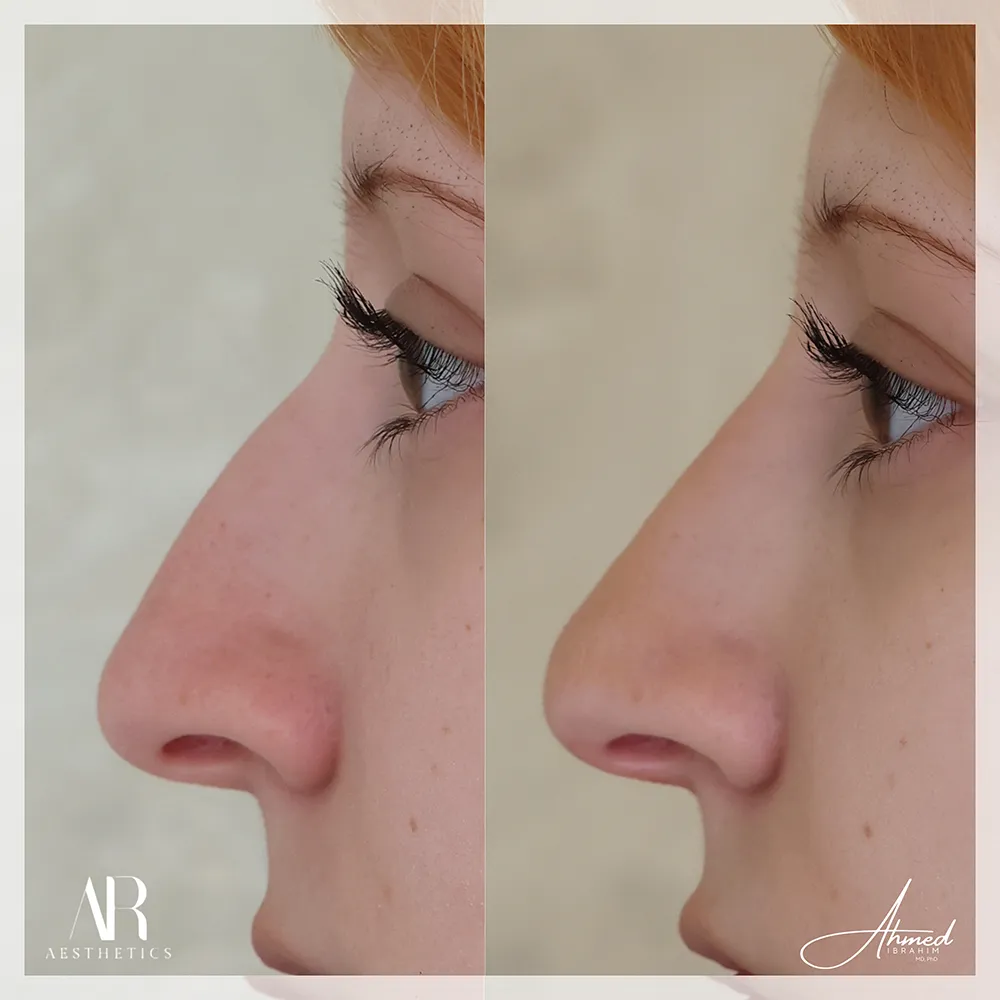 liquid-rhino-BA-01-2