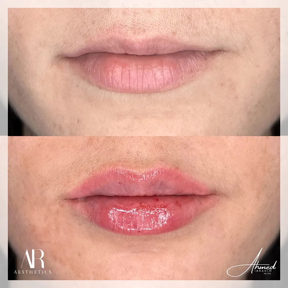 BA template (48)