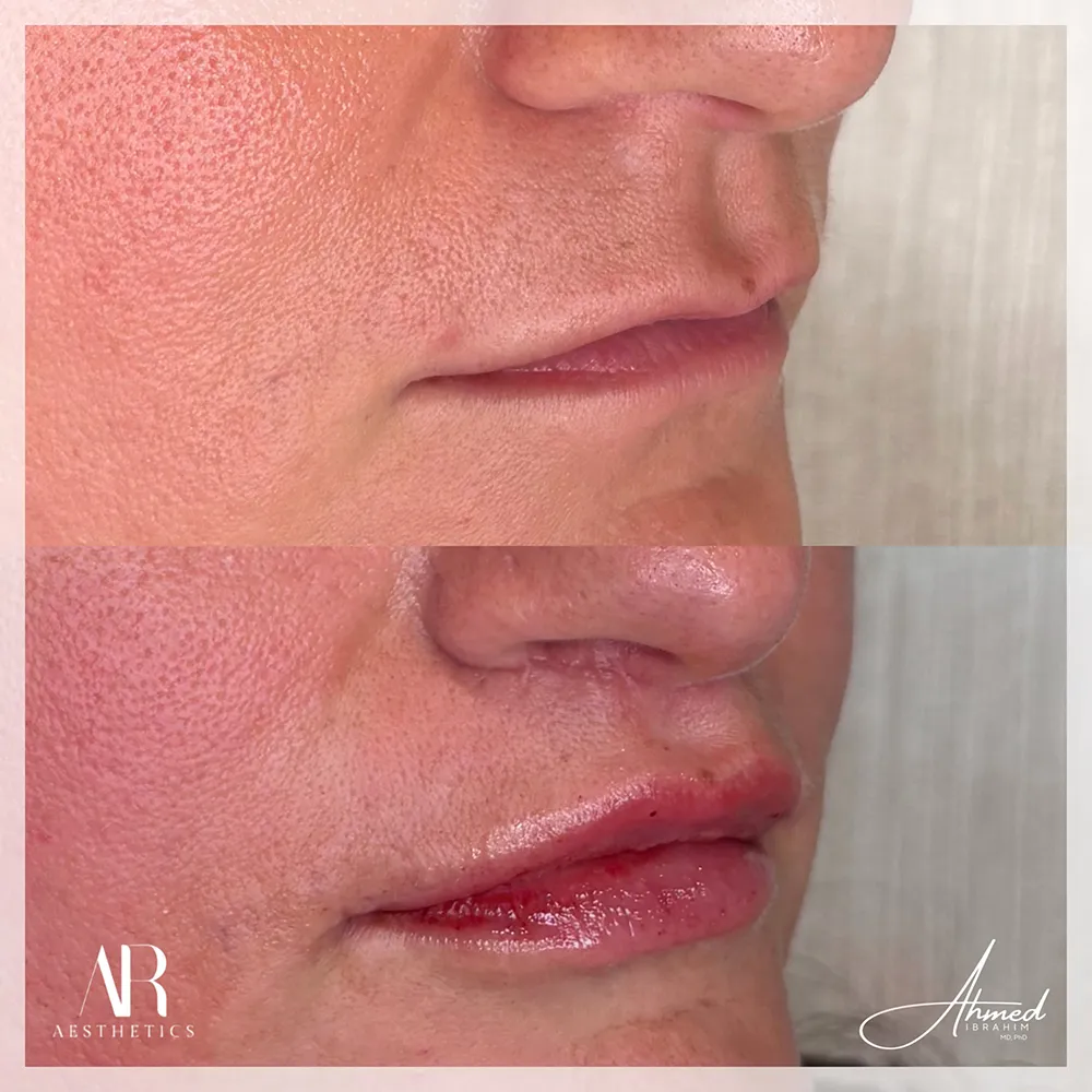 Facetune_26-06-2026-22-11-12